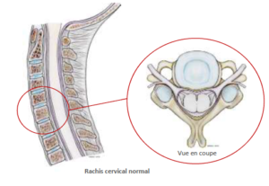 Rachis cervical normal SFCR Denux